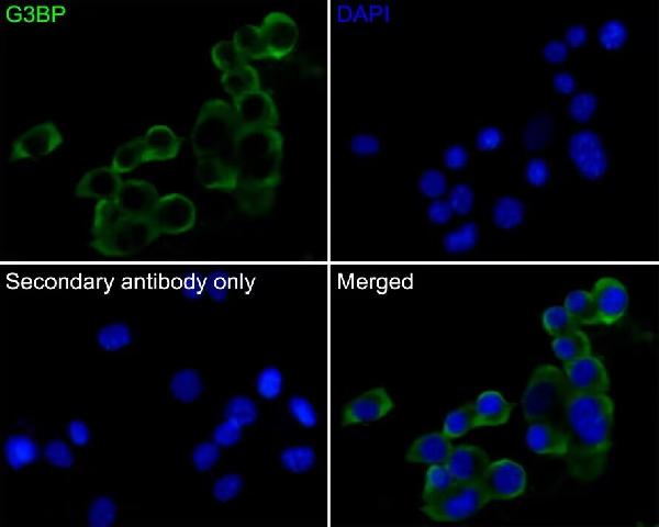 3 - Anti-G3BP Rabbit Monoclonal Antibody ABO15705