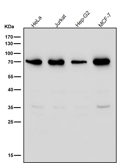 1 - Anti-G3BP Rabbit Monoclonal Antibody ABO15705