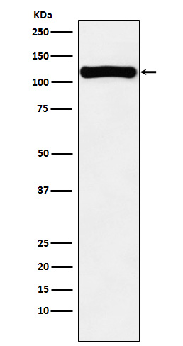 1 - Anti-VPS11 Rabbit Monoclonal Antibody ABO15708