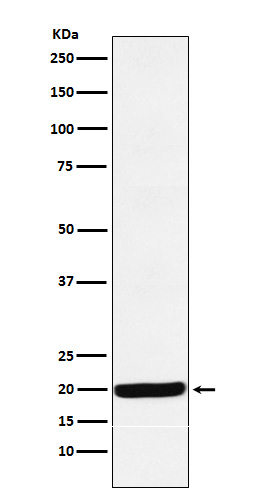1 - Anti-Y14 Rabbit Monoclonal Antibody ABO15709