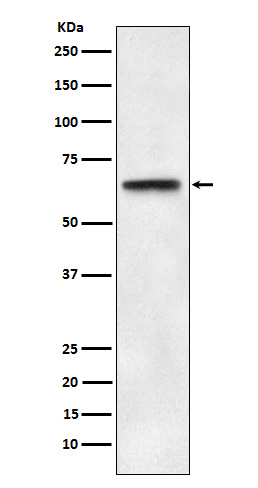 1 - Anti-ABCE1 Rabbit Monoclonal Antibody ABO15710