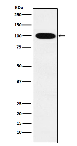 1 - Anti-VPS18 Rabbit Monoclonal Antibody ABO15714