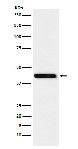 1 - Anti-Cystathionase Rabbit Monoclonal Antibody ABO15717