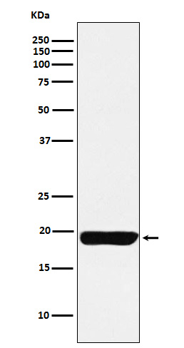 1 - Anti-MYL9 Rabbit Monoclonal Antibody ABO15718