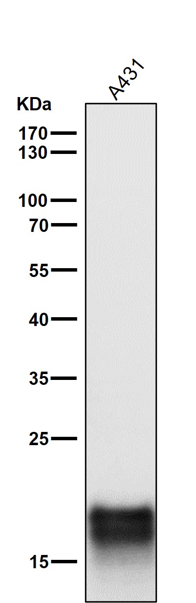 1 - Anti-MYL9 Rabbit Monoclonal Antibody ABO15718