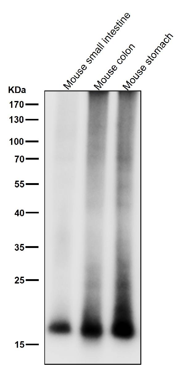 1 - Anti-MYL9 Rabbit Monoclonal Antibody ABO15718