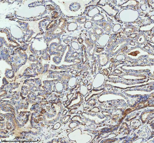 2 - Anti-PAR2 Rabbit Monoclonal Antibody ABO15719
