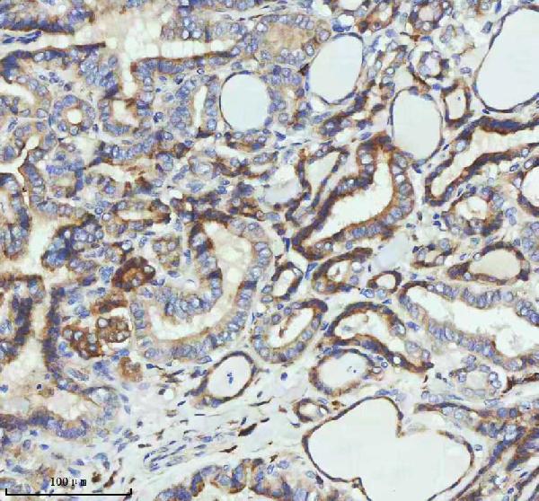 2 - Anti-PAR2 Rabbit Monoclonal Antibody ABO15719
