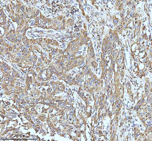 2 - Anti-PAR2 Rabbit Monoclonal Antibody ABO15719