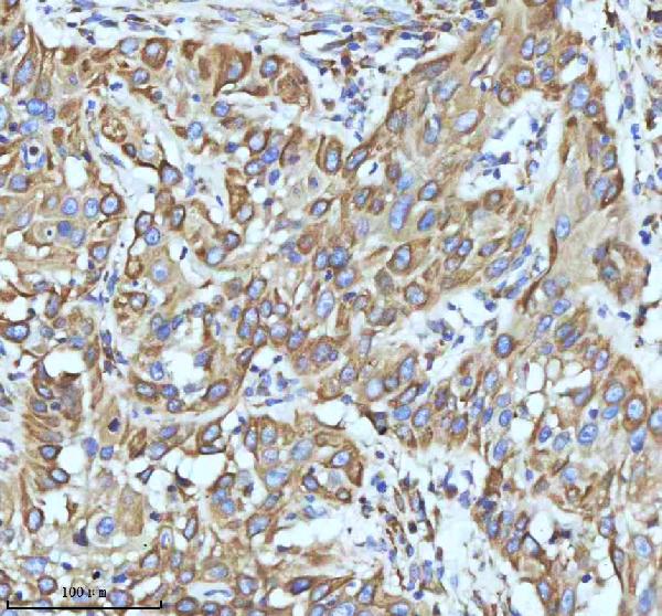 2 - Anti-PAR2 Rabbit Monoclonal Antibody ABO15719