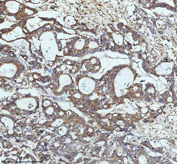 2 - Anti-PAR2 Rabbit Monoclonal Antibody ABO15719