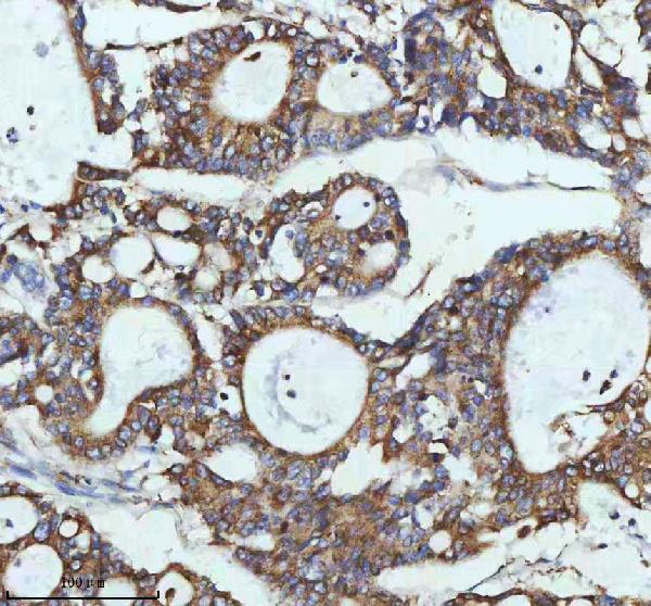 2 - Anti-PAR2 Rabbit Monoclonal Antibody ABO15719