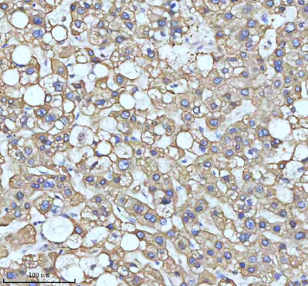 2 - Anti-PAR2 Rabbit Monoclonal Antibody ABO15719