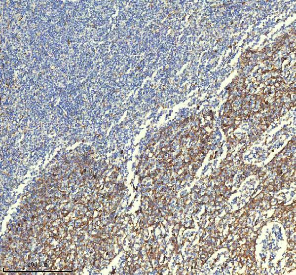 2 - Anti-PAR2 Rabbit Monoclonal Antibody ABO15719
