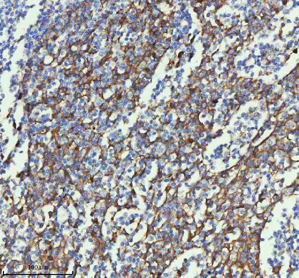 2 - Anti-PAR2 Rabbit Monoclonal Antibody ABO15719