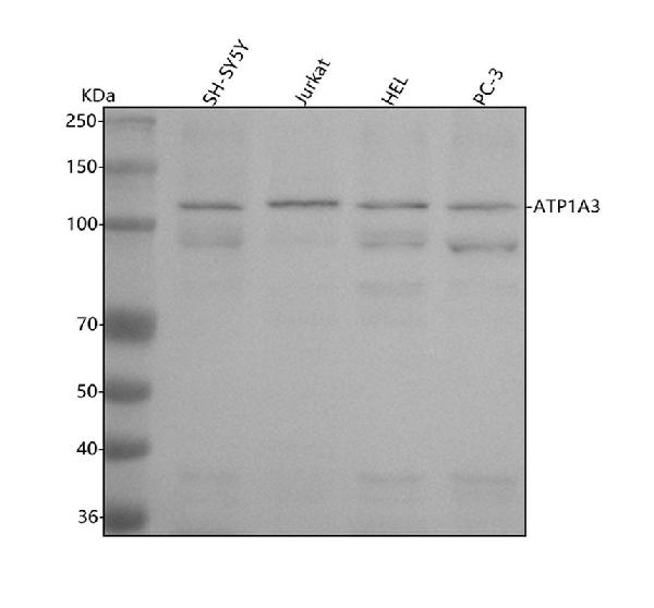 1 - Anti-ATP1A3 Rabbit Monoclonal Antibody ABO15722