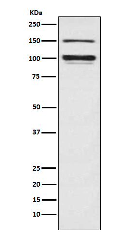 1 - Anti-ATP1A3 Rabbit Monoclonal Antibody ABO15722