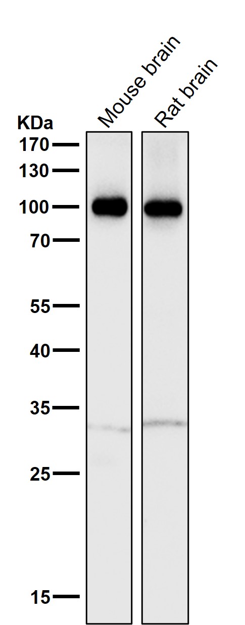 1 - Anti-ATP1A3 Rabbit Monoclonal Antibody ABO15722