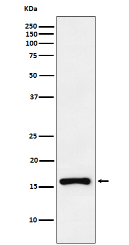1 - Anti-CDKN2C Rabbit Monoclonal Antibody ABO15723