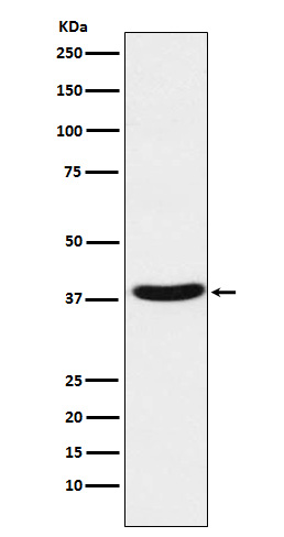1 - Anti-MT-ND1 Rabbit Monoclonal Antibody ABO15725