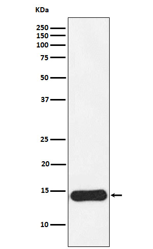 1 - Anti-CRABP1 Rabbit Monoclonal Antibody ABO15726