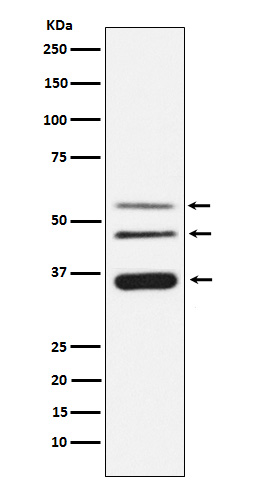 1 - Anti-Legumain Rabbit Monoclonal Antibody ABO15728