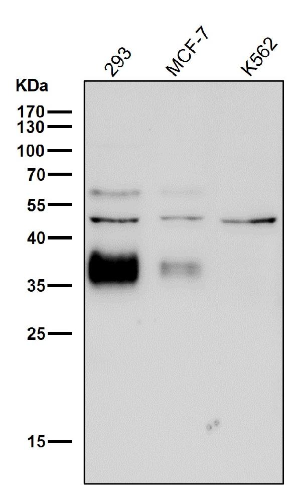 1 - Anti-Legumain Rabbit Monoclonal Antibody ABO15728