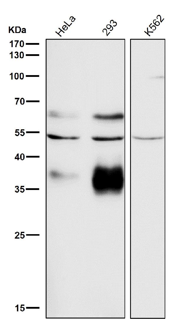 1 - Anti-Legumain Rabbit Monoclonal Antibody ABO15728