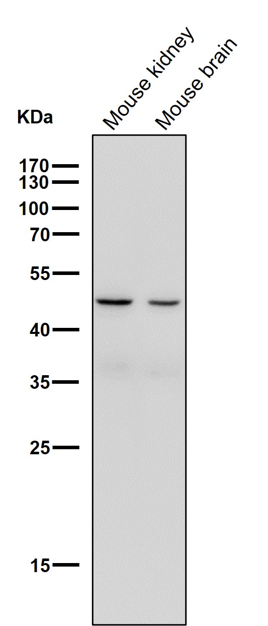 1 - Anti-Legumain Rabbit Monoclonal Antibody ABO15728