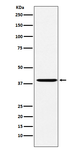 1 - Anti-CAPG Rabbit Monoclonal Antibody ABO15732