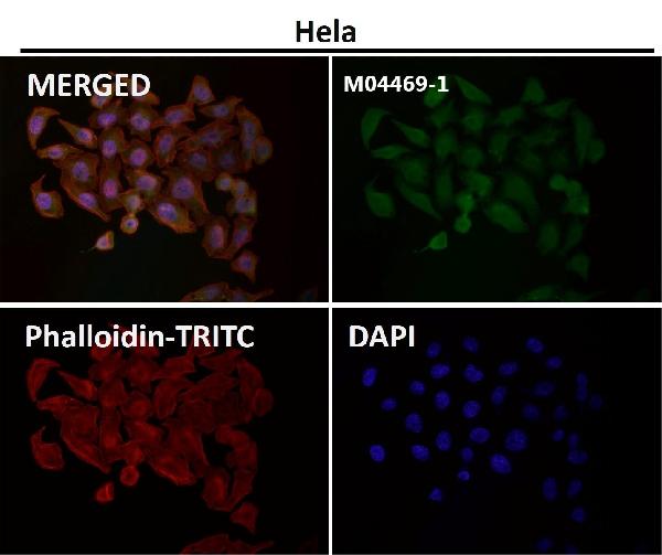 1 - Anti-DLAT Rabbit Monoclonal Antibody ABO15733