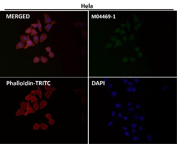 1 - Anti-DLAT Rabbit Monoclonal Antibody ABO15733