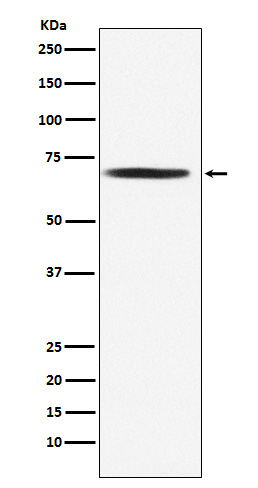 1 - Anti-DLAT Rabbit Monoclonal Antibody ABO15733
