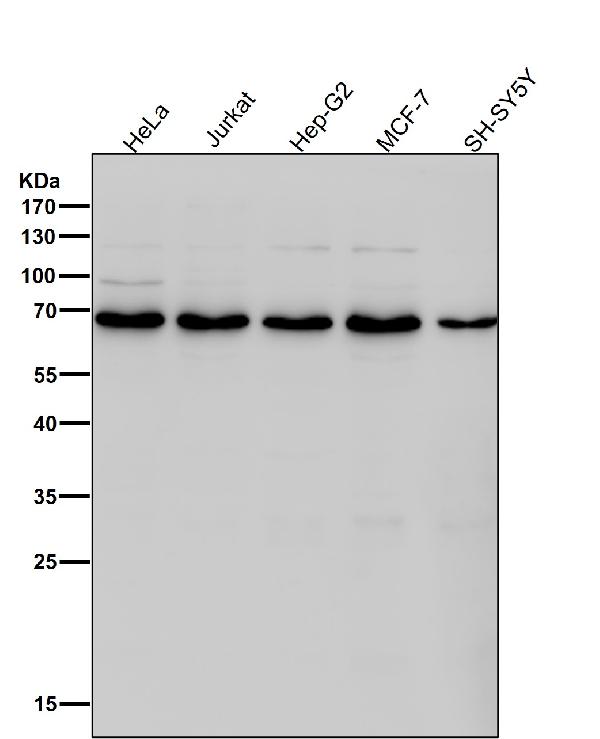 1 - Anti-DLAT Rabbit Monoclonal Antibody ABO15733