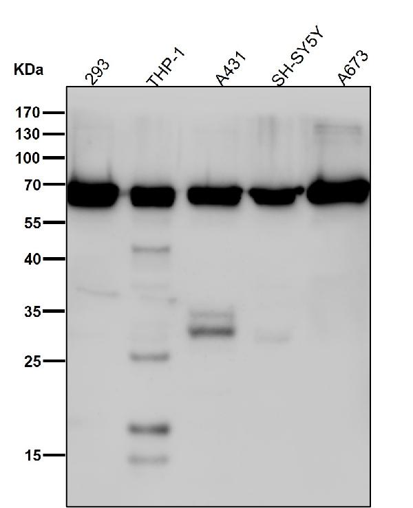 1 - Anti-DLAT Rabbit Monoclonal Antibody ABO15733