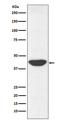 1 - Anti-IDH1 Rabbit Monoclonal Antibody ABO15734