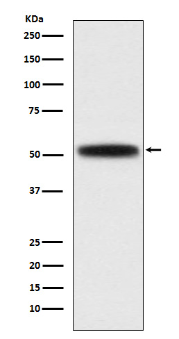 1 - Anti-DGAT1 Rabbit Monoclonal Antibody ABO15735
