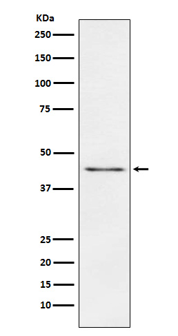 1 - Anti-Carboxypeptidase A1+A2+B Rabbit Monoclonal Antibody ABO15737