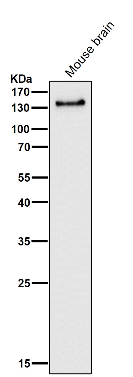 1 - Anti-PER2 Rabbit Monoclonal Antibody ABO15738