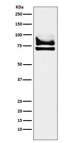 1 - Anti-DDX17 Rabbit Monoclonal Antibody ABO15739