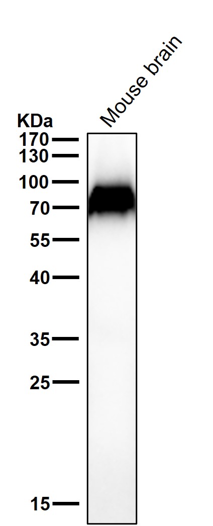 1 - Anti-DDX17 Rabbit Monoclonal Antibody ABO15739