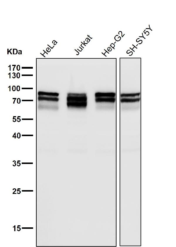 1 - Anti-DDX17 Rabbit Monoclonal Antibody ABO15739