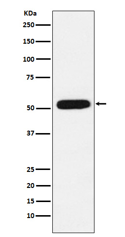 1 - Anti-CBX4 Rabbit Monoclonal Antibody ABO15740