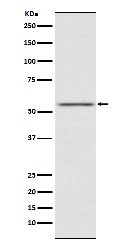 1 - Anti-AMHR2 Rabbit Monoclonal Antibody ABO15742