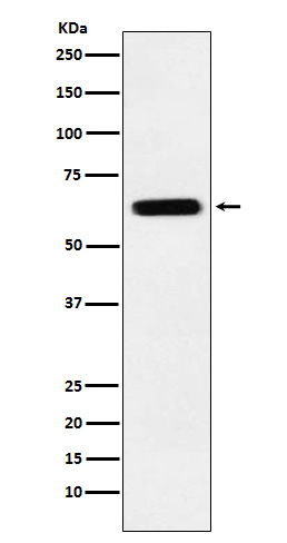 1 - Anti-CRMP5 Rabbit Monoclonal Antibody ABO15744