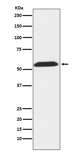1 - Anti-TXNRD2 Rabbit Monoclonal Antibody ABO15747