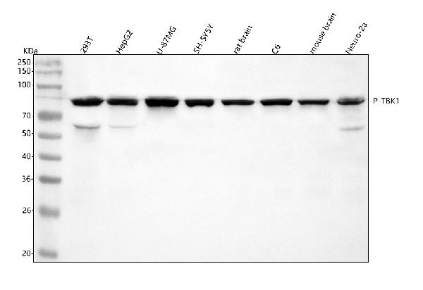 1 - Anti-Phospho-NAK/TBK1 (S172) Rabbit Monoclonal Antibody ABO15752