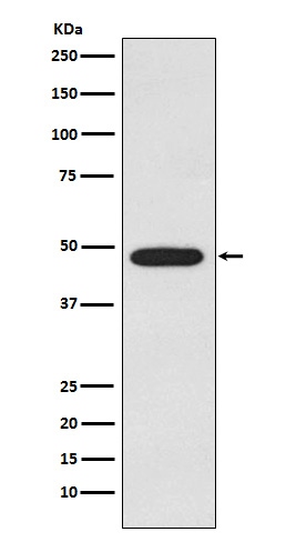 1 - Anti-Galactosidase alpha Rabbit Monoclonal Antibody ABO15753