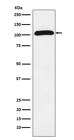 1 - Anti-ROR2 Rabbit Monoclonal Antibody ABO15755