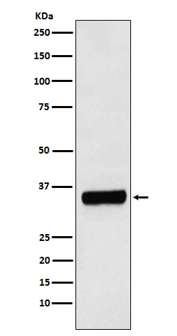 1 - Anti-PRKRA Rabbit Monoclonal Antibody ABO15756